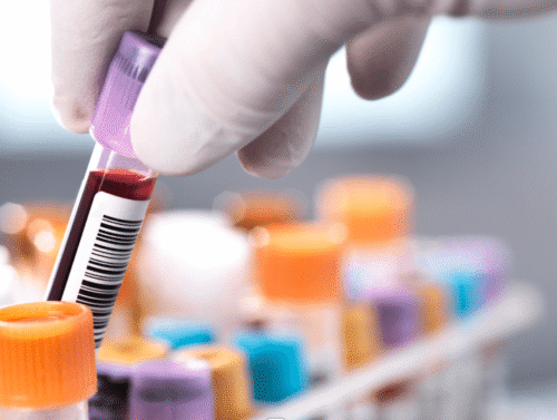 private blood tests and health screening {{brizy_dc_image_alt imageSrc=